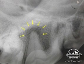 Radiografia intra-oral mostra lesão indicativa de abscesso (setas amarelas) o que indica que este dente está desvitalizado e precisa de tratamento de canal.