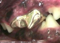 Dor de dente Pet restauração metálica